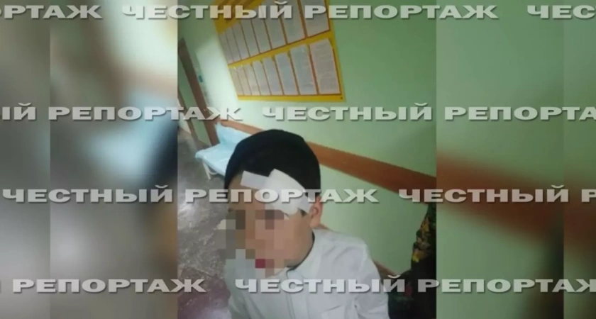 В школе Башкирии учитель избил ребенка линейкой и не пускал детей в туалет