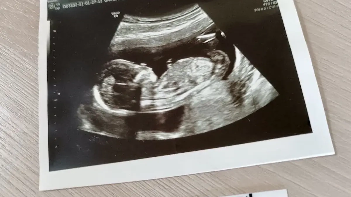 Башкирия обновит маршрутизацию беременных: трёхуровневая система с 2025 года